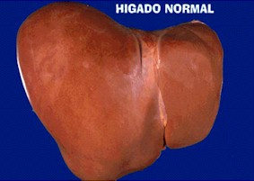Hígado normal - FEHV